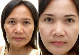 Review Dakami từ người dùng