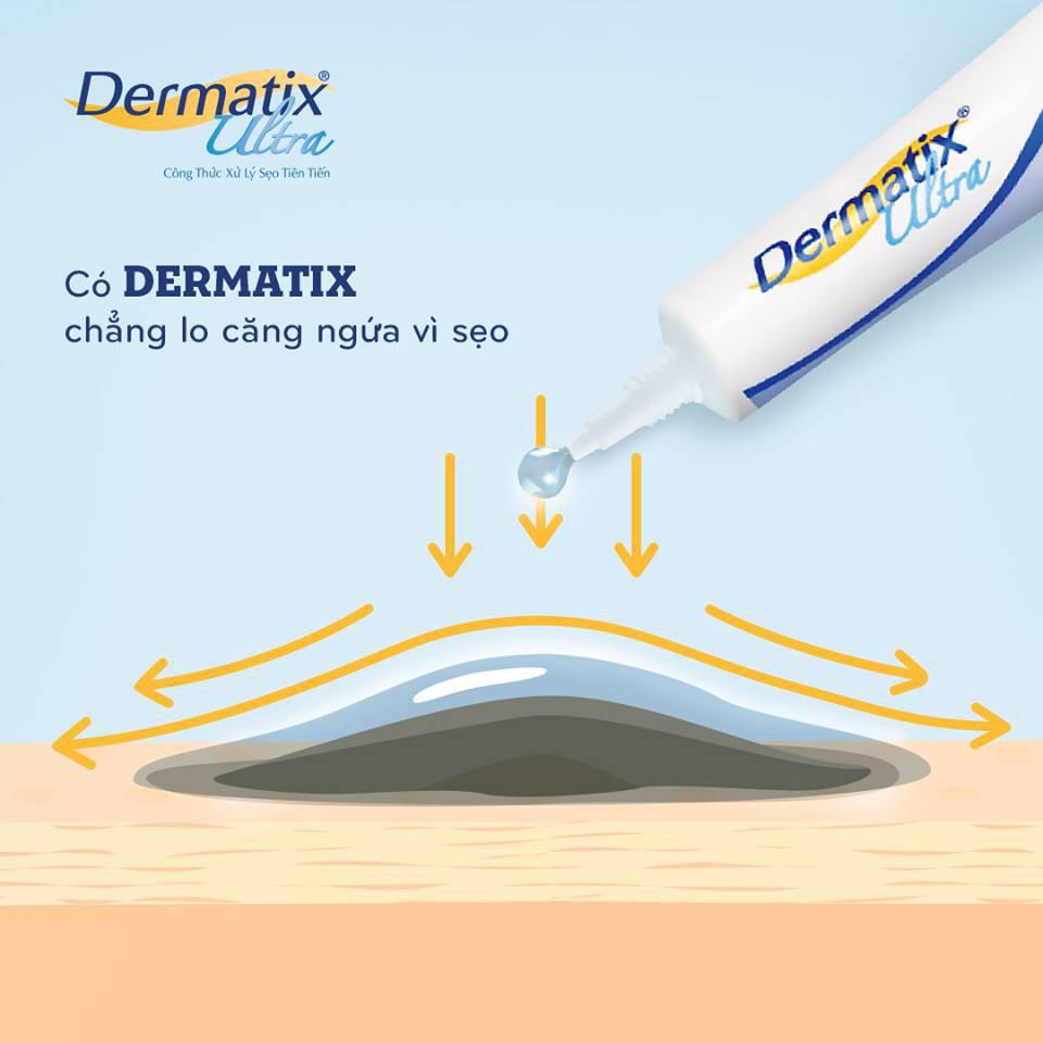 DERMATIX CÓ HIỆU QUẢ KHÔNG