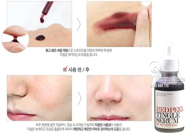 RED PEEL TINGLE SERUM CÓ TỐT KHÔNG