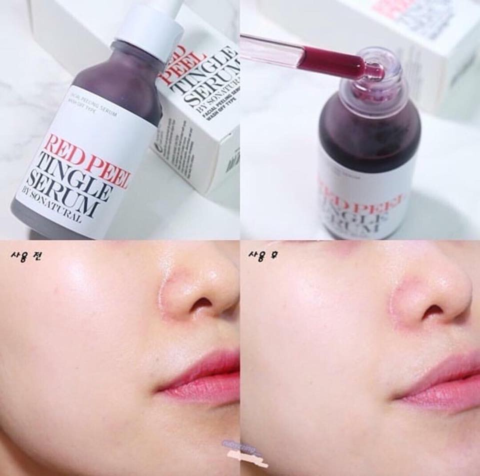 RED PEEL TINGLE SERUM CÓ TÁC DỤNG GÌ