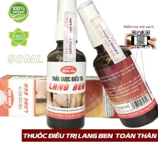 Thuốc trị lang beng Hồng Sơn