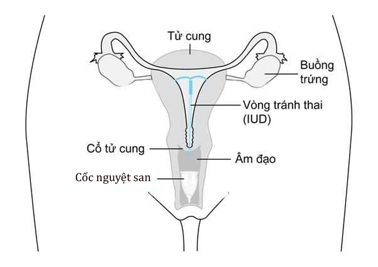 1 SỐ CÂU HỎI KHI DÙNG CỐC NGUYỆT SAN