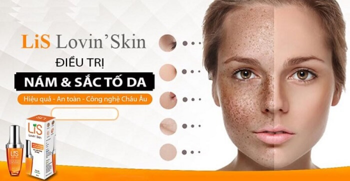 Đối tượng sử dụng Lis Lovin Skin