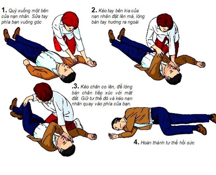 Nhận biết đột quỵ - Sơ cứu bệnh nhân đột quỵ Cách đặt bệnh nhân về tư thế nằm nghiêng an toàn