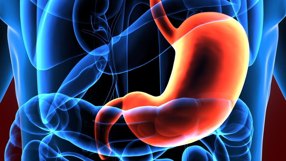 Sàng lọc ung thư dạ dày hiệu quả Gói khám sàng lọc ung thư ung thư thực quản dạ dày 1