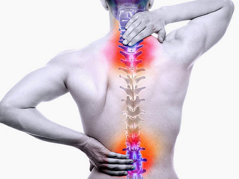 Thoát vị đĩa đệm là gì? Nên tập trị liệu hay phẫu thuật Khi Nào Nên Phẫu Thuật Thoát Vị Đĩa Đệm Cột Sống Thắt Lưng?