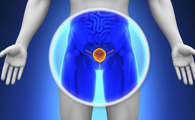 Vấn đề cơ bản cần biết về phì đại tuyến tiền liệt Phì đại tuyến tiền liệt