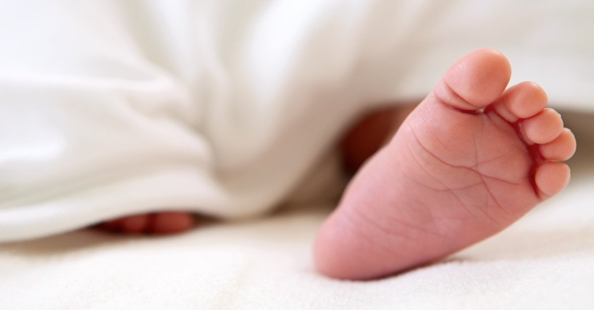 sàng lọc sơ sinh giúp phát hiện suy thận bẩm sinh