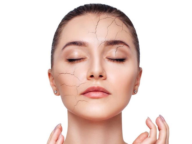 Da khô là gì? Tình trạng da khô Kem Dưỡng Ban Ngày Da Khô Hồi Phục Cấp Tốc