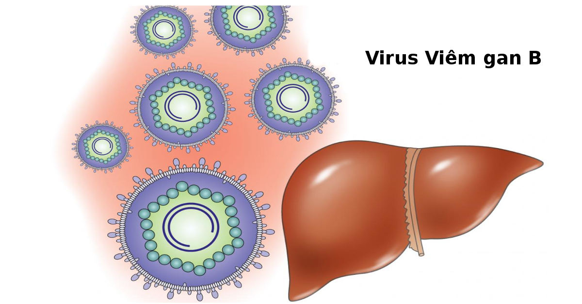 Virus viêm gan B: Những điểm cần lưu ý Viêm gan B: Triệu chứng, nguyên nhân, điều trị ở đâu tốt?