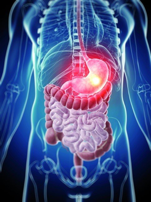 Phương pháp nội soi dạ dày, đại tràng có gây mê