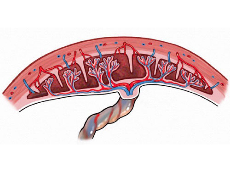 Biến chứng nguy hiểm của cài răng lược và cách xử lý Để tránh gặp biến chứng nguy hiểm của rau cài răng lược - Sản phụ cần làm gì?