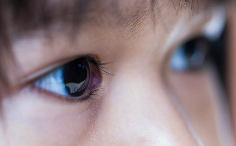 Cách phát hiện và điều trị bệnh ung thư võng mạc ở trẻ hiệu quả