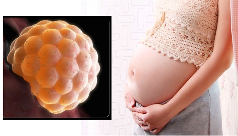 U nguyên bào nuôi là gì? Phân loại u nguyên bào nuôi U nguyên bào nuôi là gì? Phân loại u nguyên bào nuôi