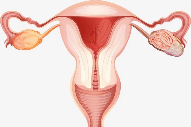 Cảnh giác biến chứng khi đặt vòng tránh thai: Thủng tử cung sau đặt vòng