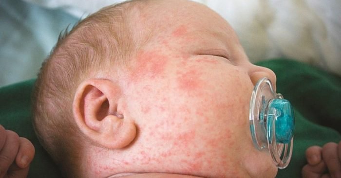 soi-moc-o-dau-truoc-1