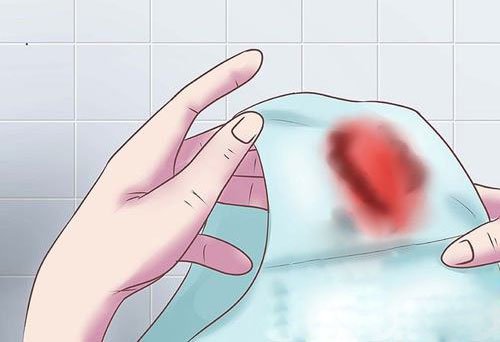 U xơ tử cung là gì? Chẩn đoán u xơ tử cung