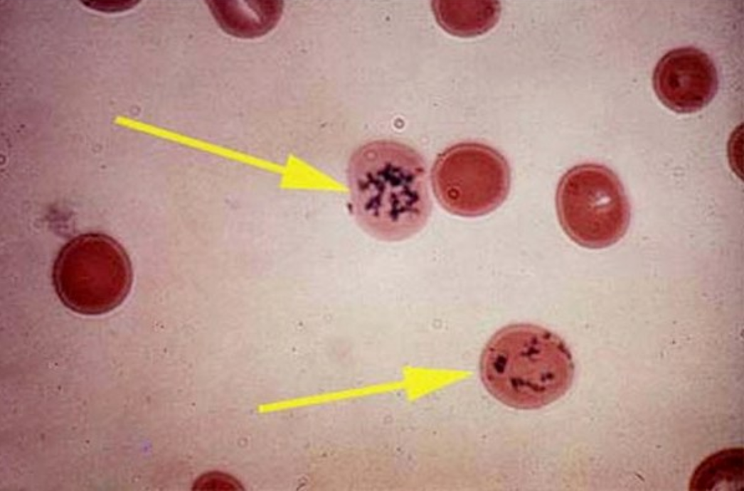 Đặc điểm máu trẻ em: Hồng cầu, bạch cầu, tiểu cầu