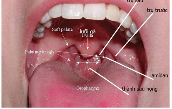 Ung thư vòm họng và diễn biến qua từng giai đoạn