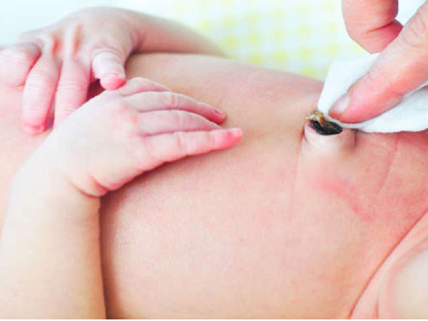 Kẹp cắt dây rốn chậm là gì? Lợi ích không ngờ từ kẹp cắt dây rốn chậm sau sinh Kẹp cắt dây rốn chậm là gì? Lợi ích không ngờ từ kẹp cắt dây rốn chậm sau sinh