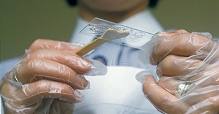 Soi tươi dịch âm đạo là gì? Ý nghĩa của xét nghiệm soi tươi dịch âm đạo Soi tươi dịch âm đạo là gì? Ý nghĩa của xét nghiệm soi tươi dịch âm đạo