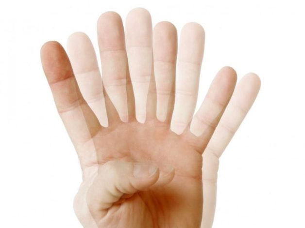 Khám phá về loạn thị nặng ở trẻ nhỏ Khám phá về loạn thị nặng ở trẻ nhỏ