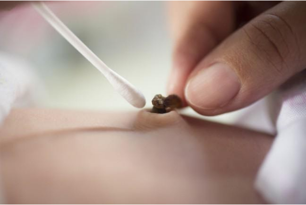 Các dấu hiệu và cách chăm sóc những bệnh lý về rốn cho trẻ sơ sinh