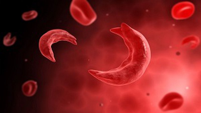 Sinh thiết nhau gai: Những điều cần biết Sinh thiết nhau gai: Những điều cần biết