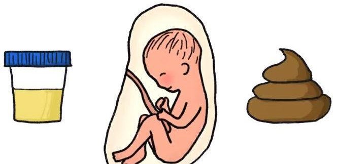 Những điều bạn cần biết về phẫu thuật nội soi điều trị tắt ruột phân su cho trẻ nhỏ