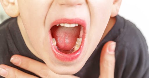 Phẫu thuật nội soi nạo VA bằng dao plasma cho trẻ có nguy hiểm không