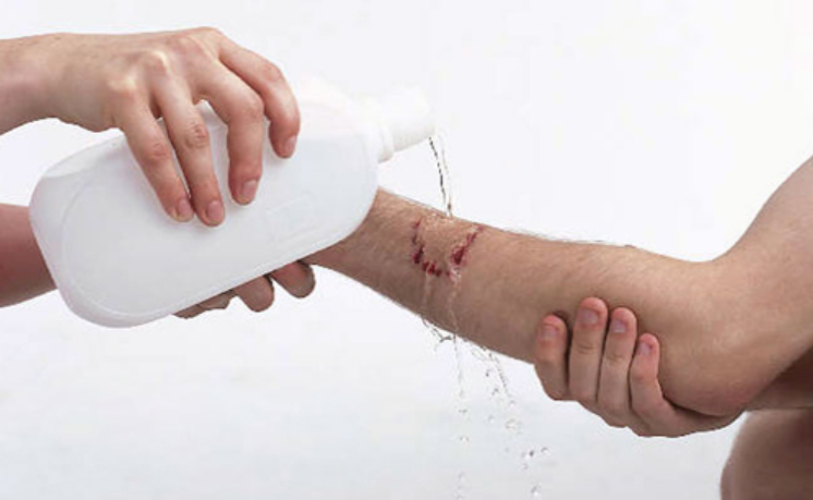 Phòng ngừa bệnh dại cho trẻ nhỏ và những điều cần biết Phòng ngừa bệnh dại cho trẻ nhỏ và những điều cần biết