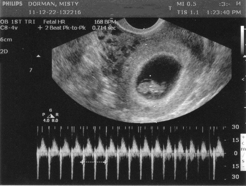 Sinh lý và tuần hoàn bào thai Sinh lý và tuần hoàn bào thai