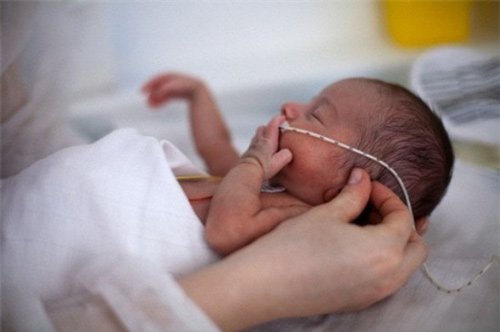 Yếu tố cổ tử cung và tử cung có ảnh hưởng như thế nào tới việc sinh non? Yếu tố cổ tử cung và tử cung có ảnh hưởng như thế nào tới việc sinh non?