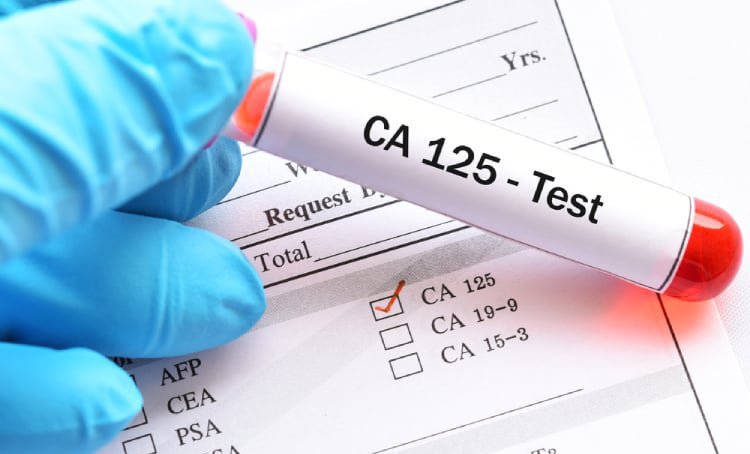 Khi nào cần khám phụ khoa?