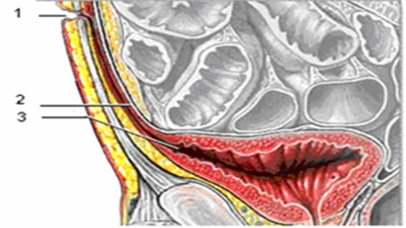 Triệu chứng và cách điều trị bệnh nang niệu rốn cho trẻ sơ sinh