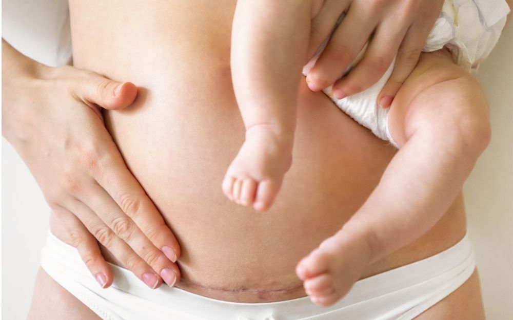 10 câu hỏi thường gặp khi sinh mổ