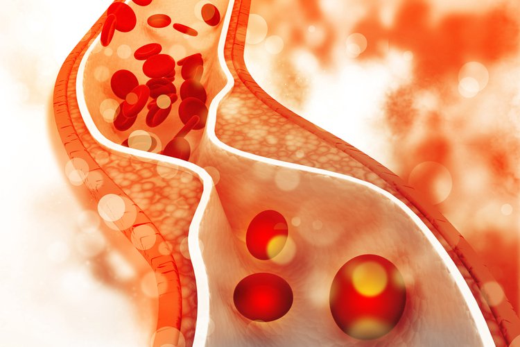 Những sự thật bất ngờ về cholesterol Cholesterol thấp