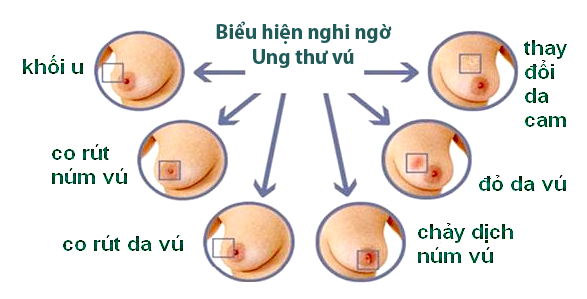 Ưu điểm và nhược điểm của chỉ số CA 15-3