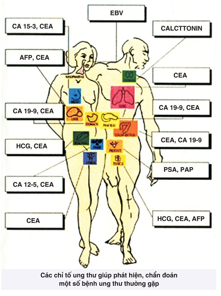 Tổng quan về các chỉ dấu ung thư quan trọng thường được sử dụng hiện nay Tổng quan về các chỉ dấu ung thư quan trọng thường được sử dụng hiện nay