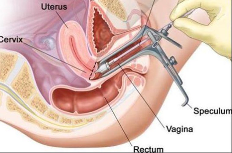 Triệu chứng và cách điều trị ung thư âm hộ