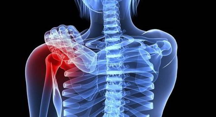 Triệu chứng và các hệ quả nghiêm trọng của ung thư xương