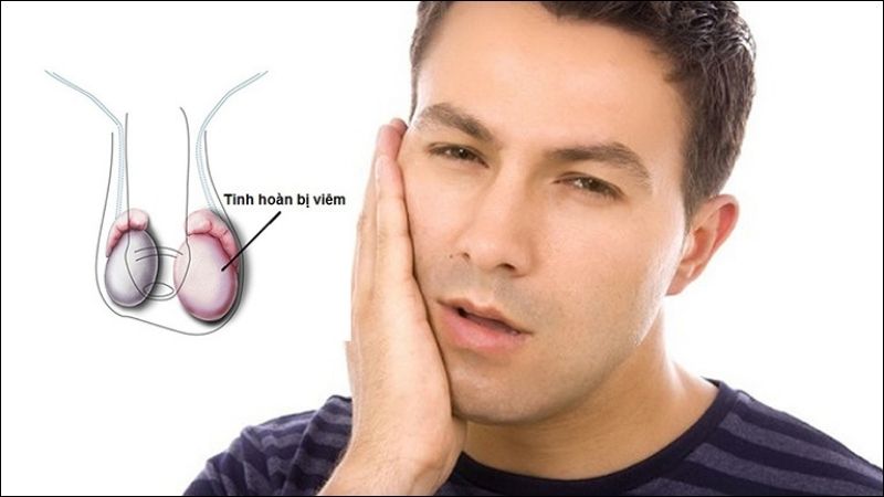 Biến chứng nguy hiểm của quai bị là gì? Cách phòng tránh