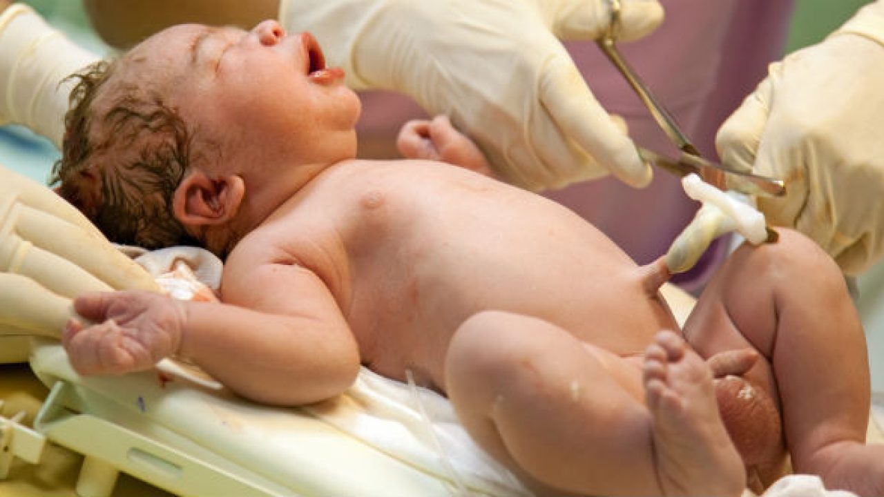 Các dấu hiệu và cách chăm sóc những bệnh lý về rốn cho trẻ sơ sinh
