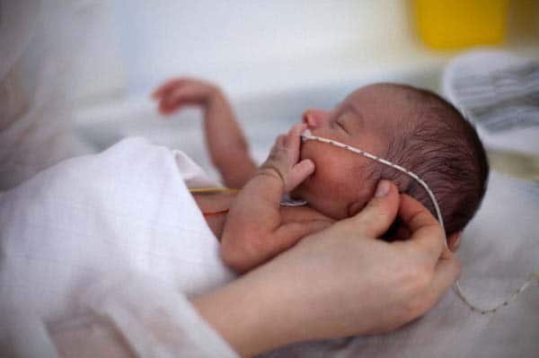 Dấu hiệu và cách chữa trị phù phổi cấp ở trẻ