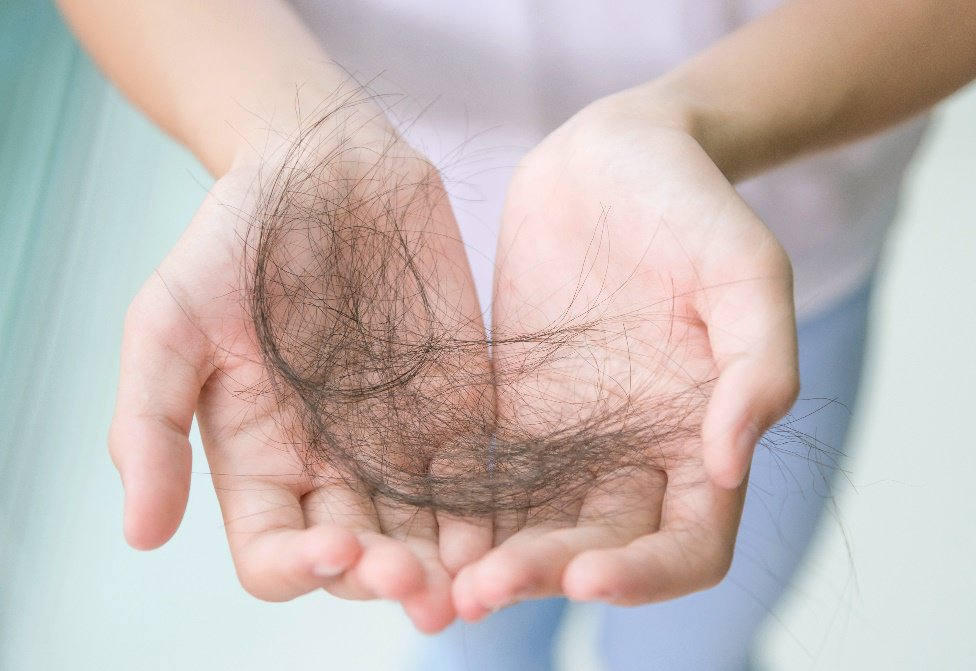 Rụng tóc do rối loạn nội tiết tố tiền mãn kinh Rụng tóc do rối loạn nội tiết tố tiền mãn kinh