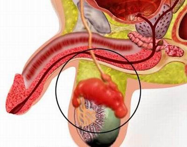 Phương pháp chẩn đoán ung thư tinh hoàn phổ biến nhất hiện nay Phương pháp chẩn đoán ung thư tinh hoàn phổ biến nhất hiện nay