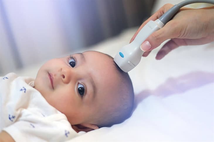 Phương pháp thực hiện chẩn đoán bằng siêu âm qua thóp