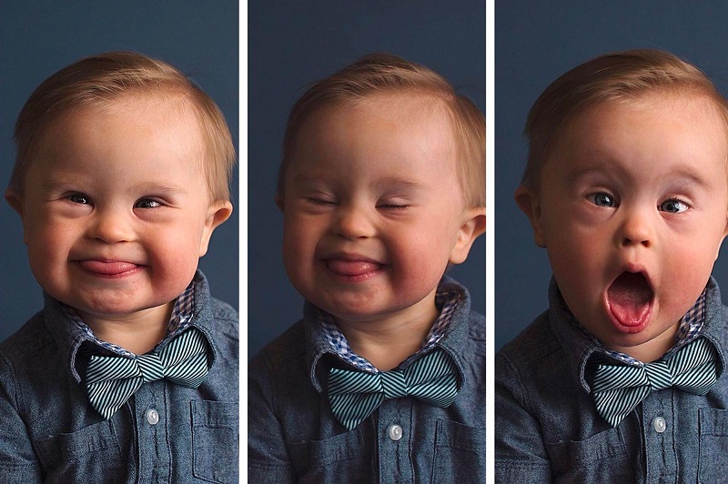 Tác dụng của sinh thiết gai nhau Tác dụng của sinh thiết gai nhau