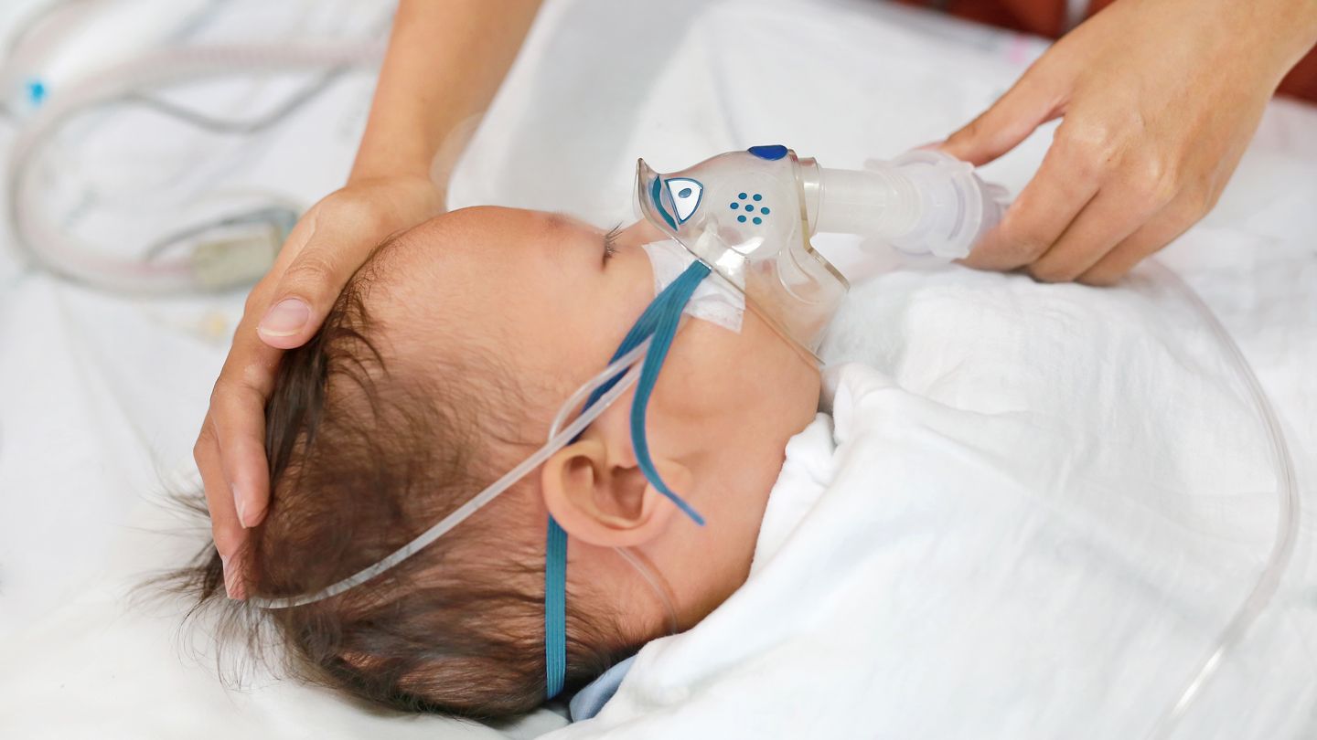 Triệu chứng và cách xử lý khi trẻ bị nhiễm virus RSV Triệu chứng và cách xử lý khi trẻ bị nhiễm virus RSV