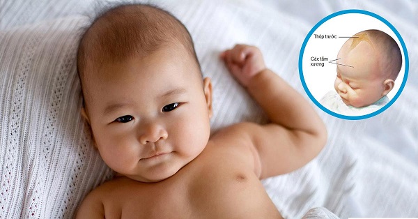 Nhận biết khi thóp trẻ phập phồng bất thường và cách chăm sóc